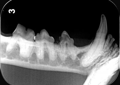 Dentales Röntgen